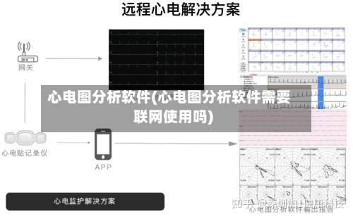 心电图分析软件(心电图分析软件需要联网使用吗)