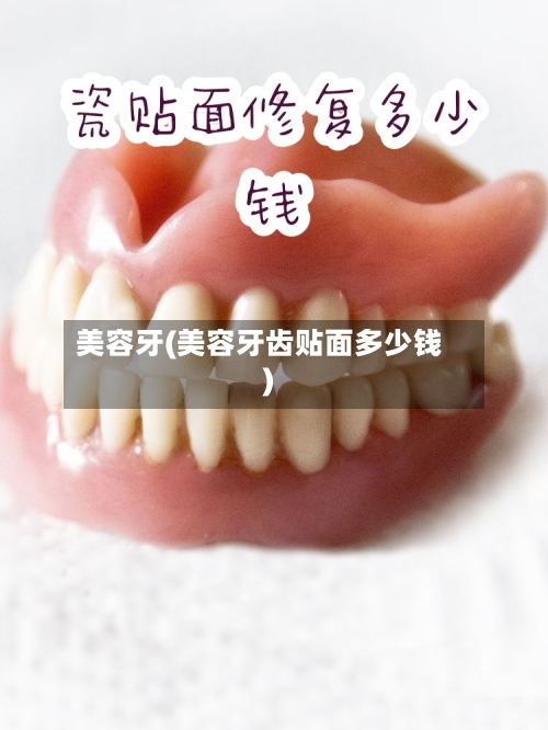 美容牙(美容牙齿贴面多少钱)-第3张图片