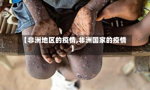 【非洲地区的疫情,非洲国家的疫情】
