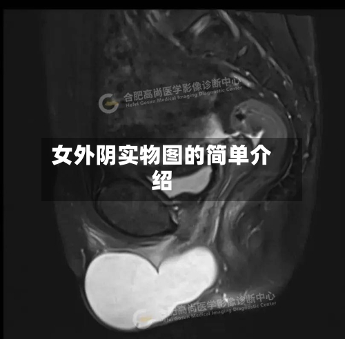 女外阴实物图的简单介绍-第2张图片