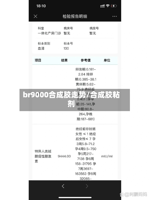 br9000合成胶走势/合成胶粘剂-第2张图片